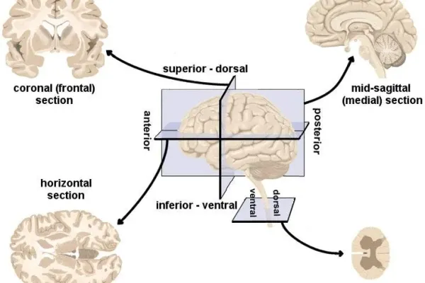 Brain anatomy diagram showing anterior-posterior orientation
